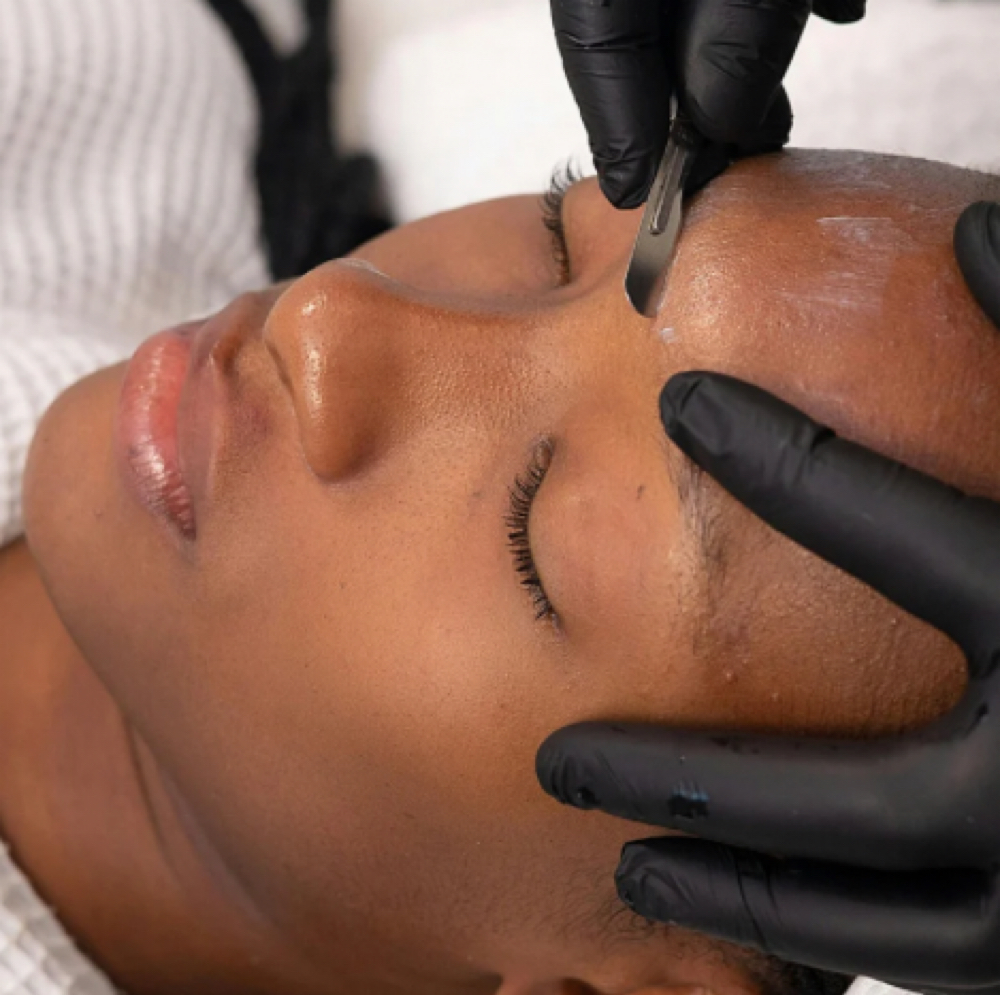 Dermaplane Facial at Onyx | Esthetics Co. in Dequeen, AR