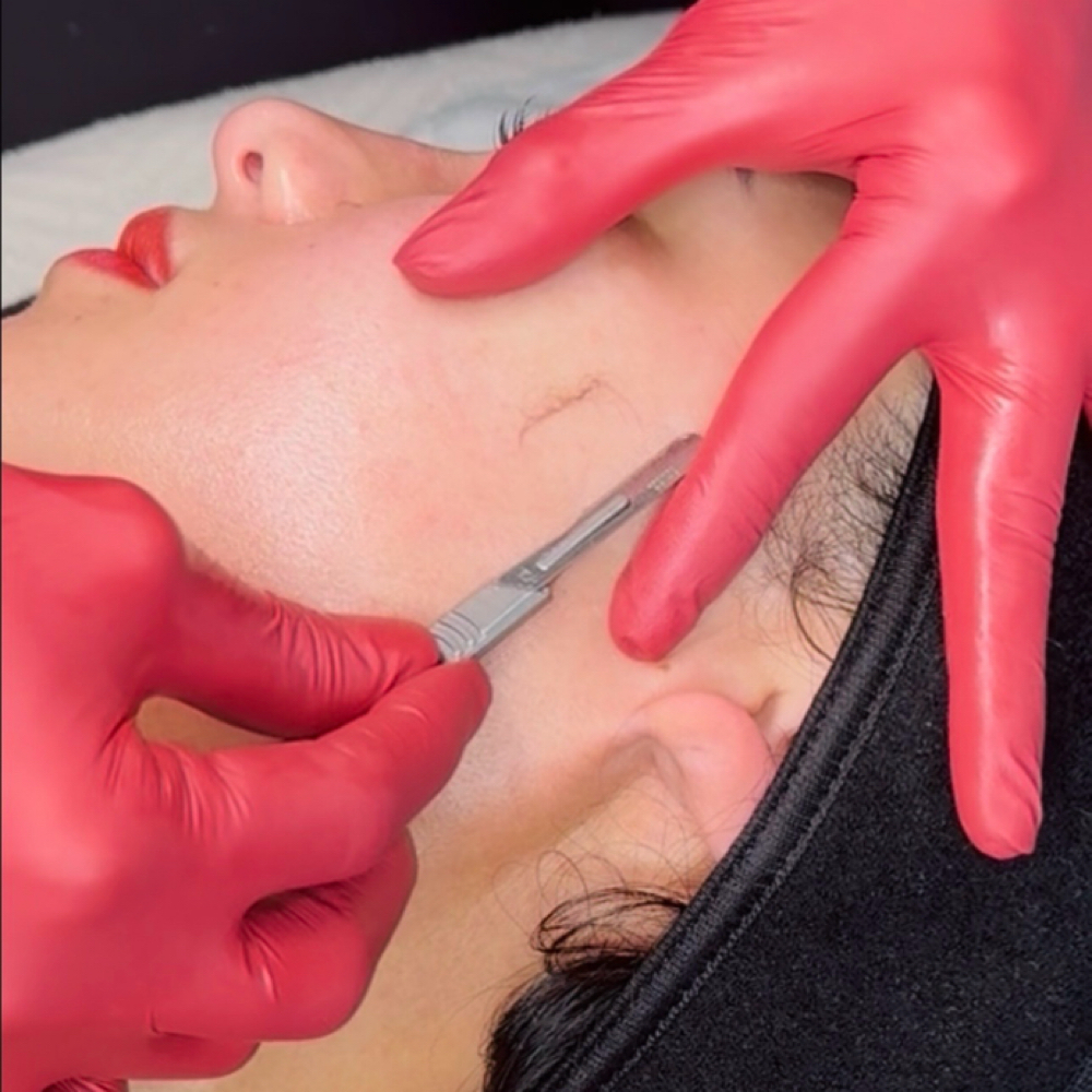Dermaplaning Formula at Facial Formula in Costa Mesa, CA