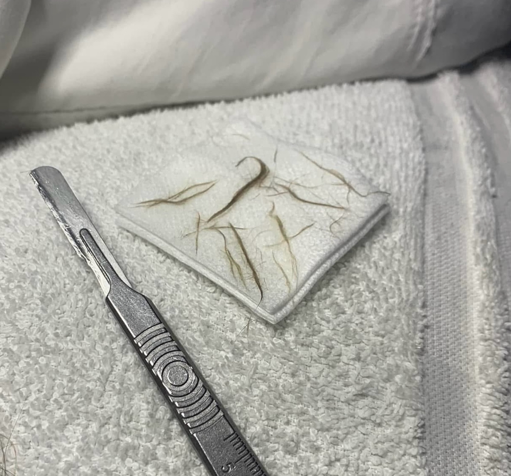 THE DERMAPLANE FACIAL