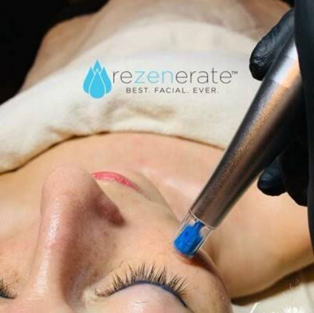 Rezenerate NanoGlow Or W/Dermaplane at Elevated Esthetics in Martinsburg, WV