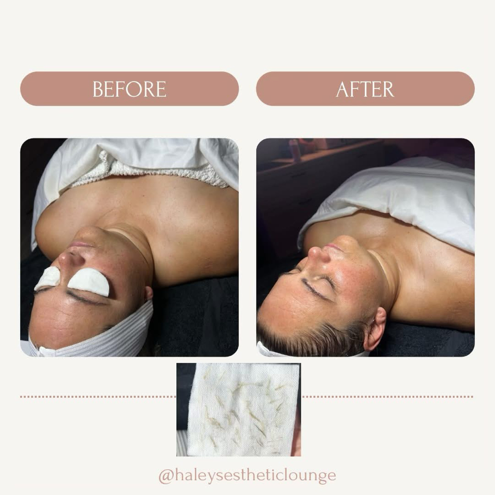 Deluxe Dermaplaning Facial