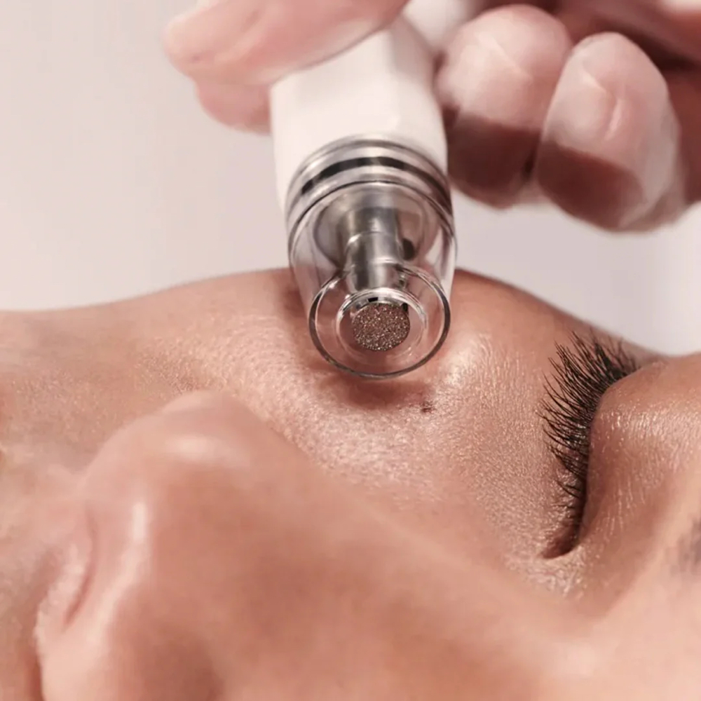 HydraDermabrasion(Diamond Glow)