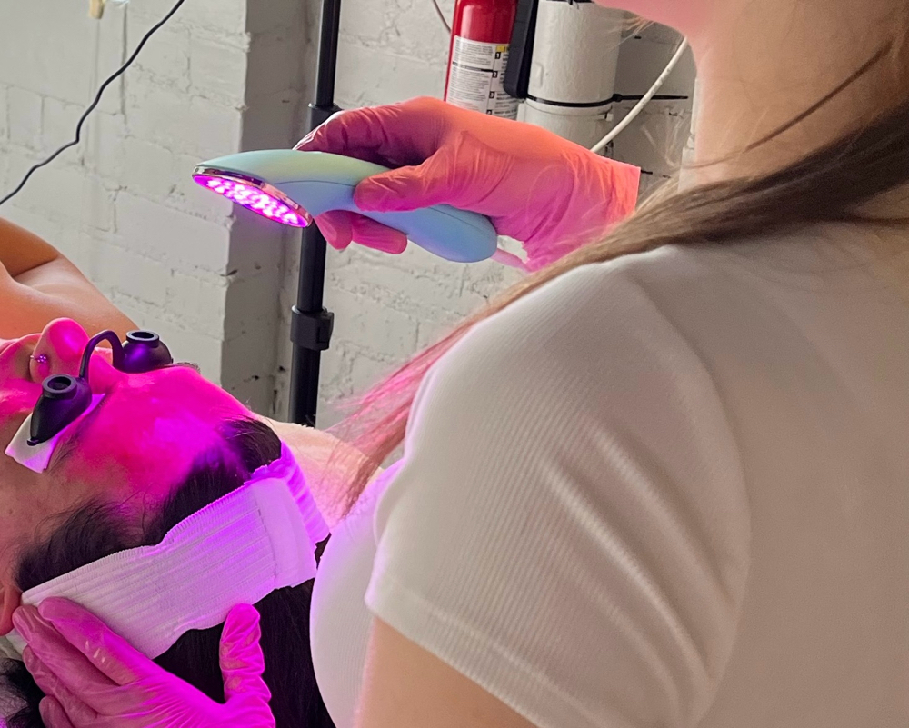 Chemical Peel + LED therapy