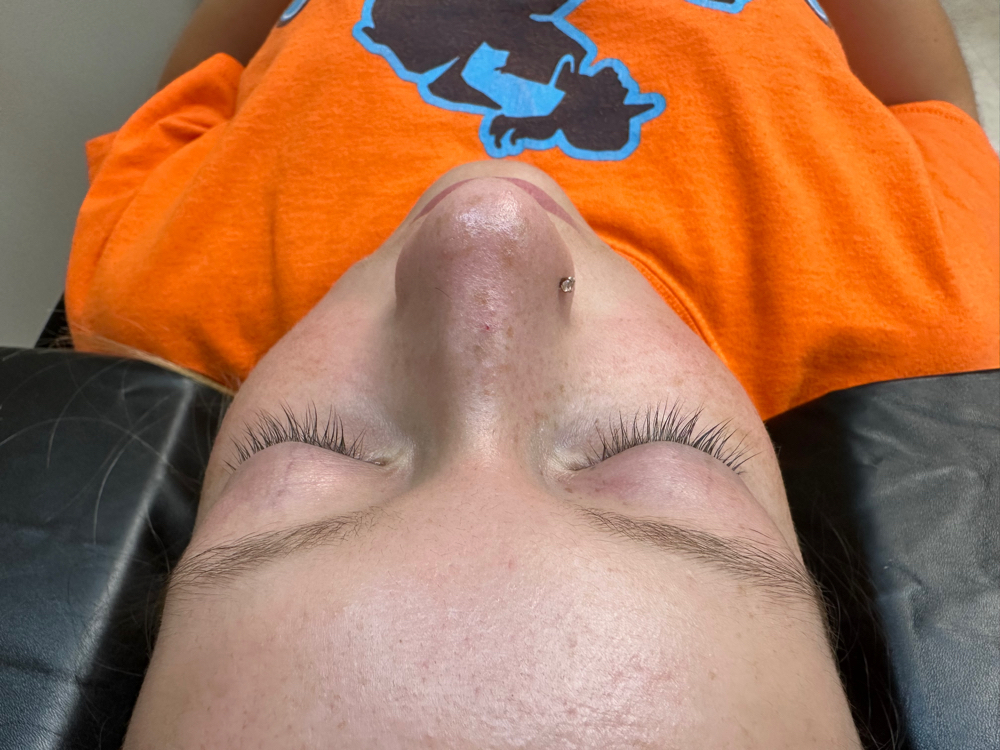 Lash Removal