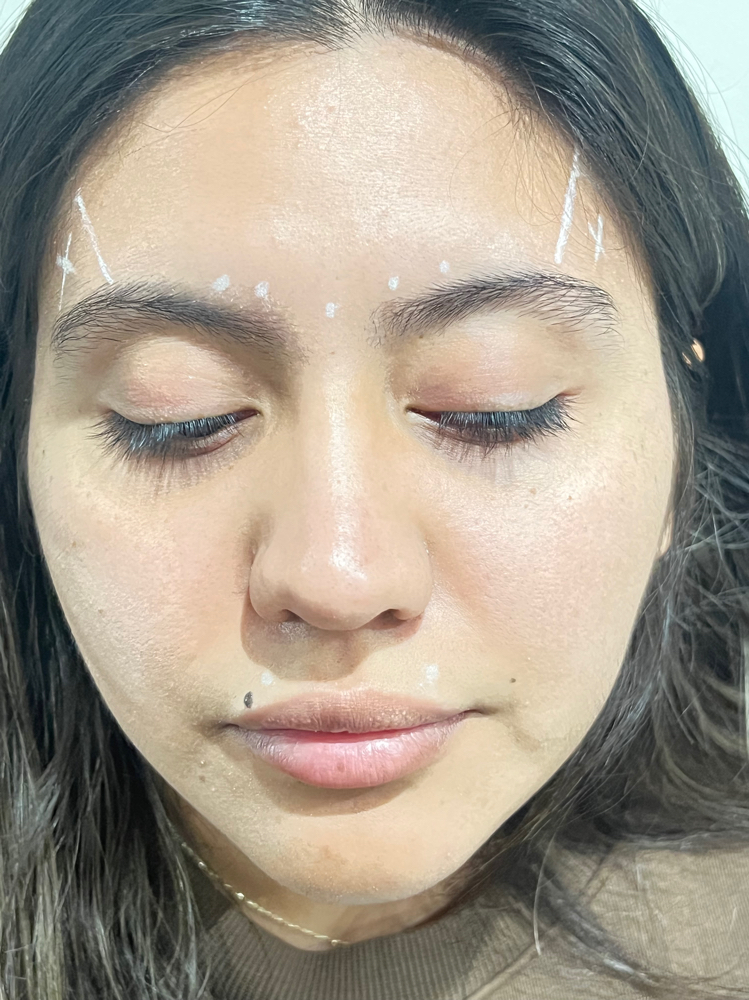 Botox at Bratz Bliss by Yesenia in Fort Worth, TX