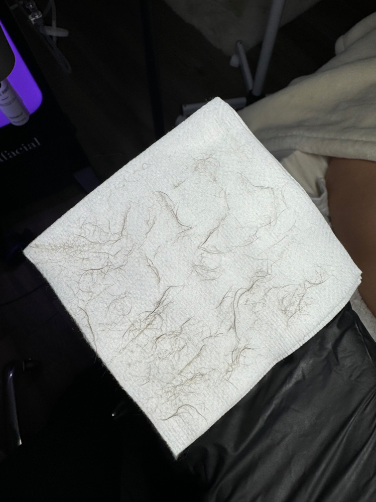 Dermaplane Facial