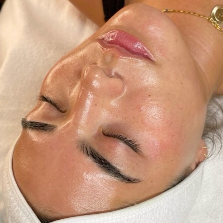 The Legacy Renewal Treatment at Jennifer Marie Skincare in Elkhart, IN