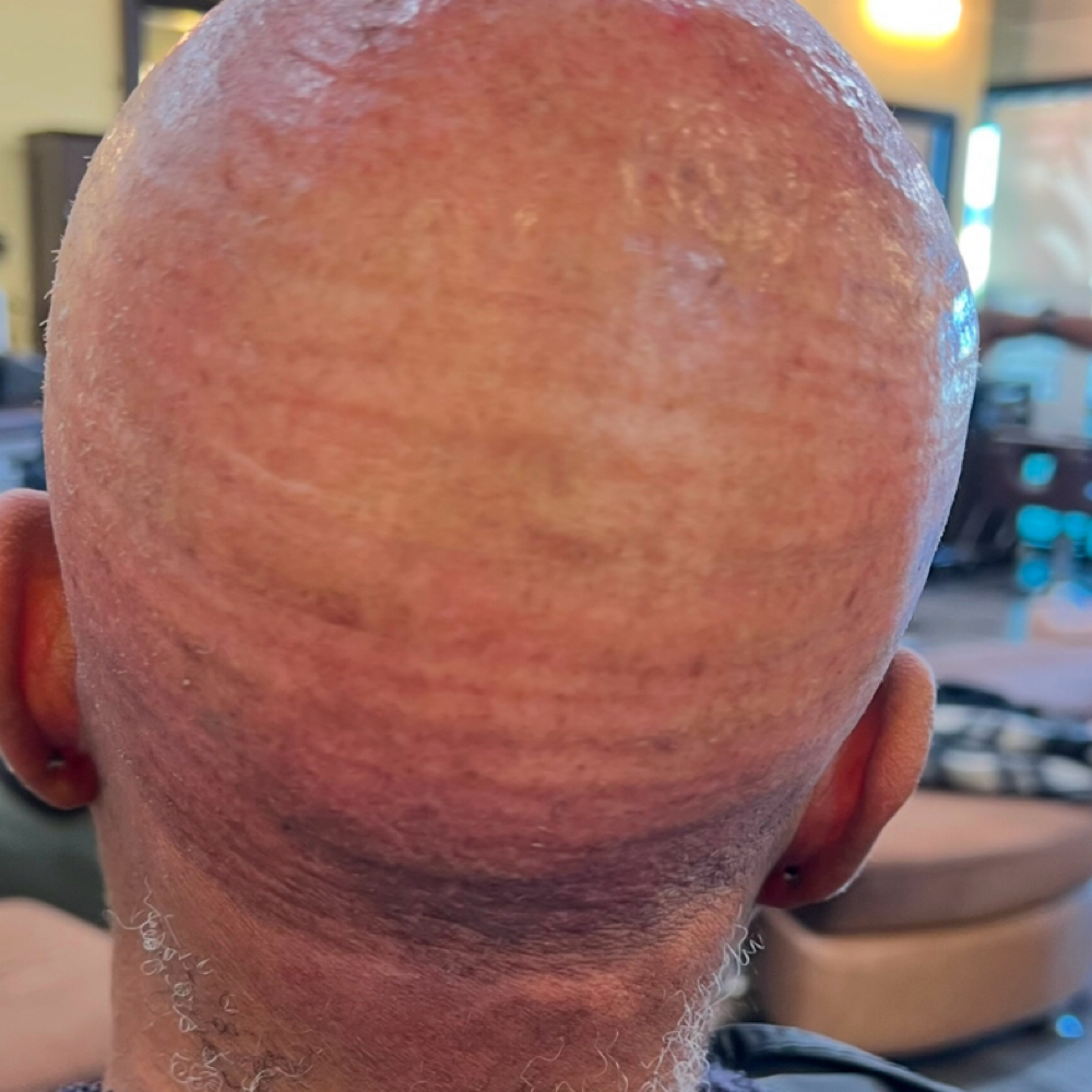 Alopecia Quick Weave at At Salon122 in Duncanville, TX