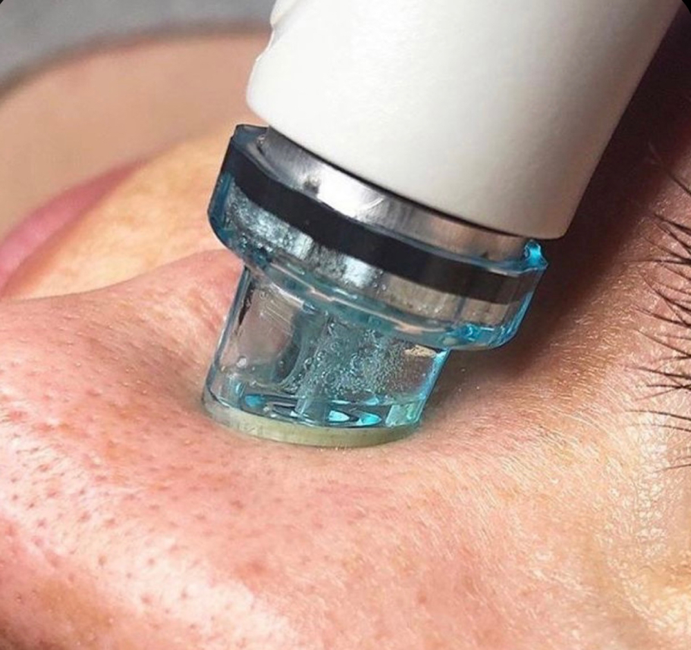 Hydrafacial