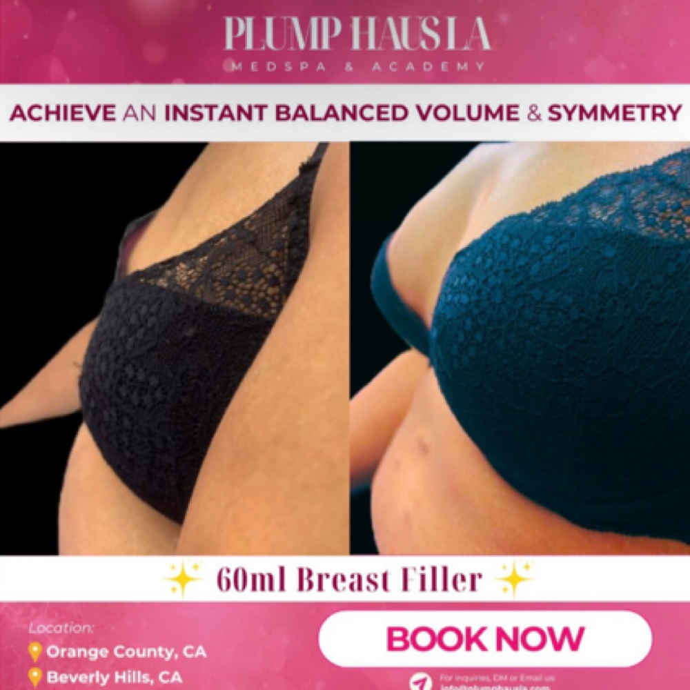 Breast Filler at Plump Haus LA in Beverly Hills, CA