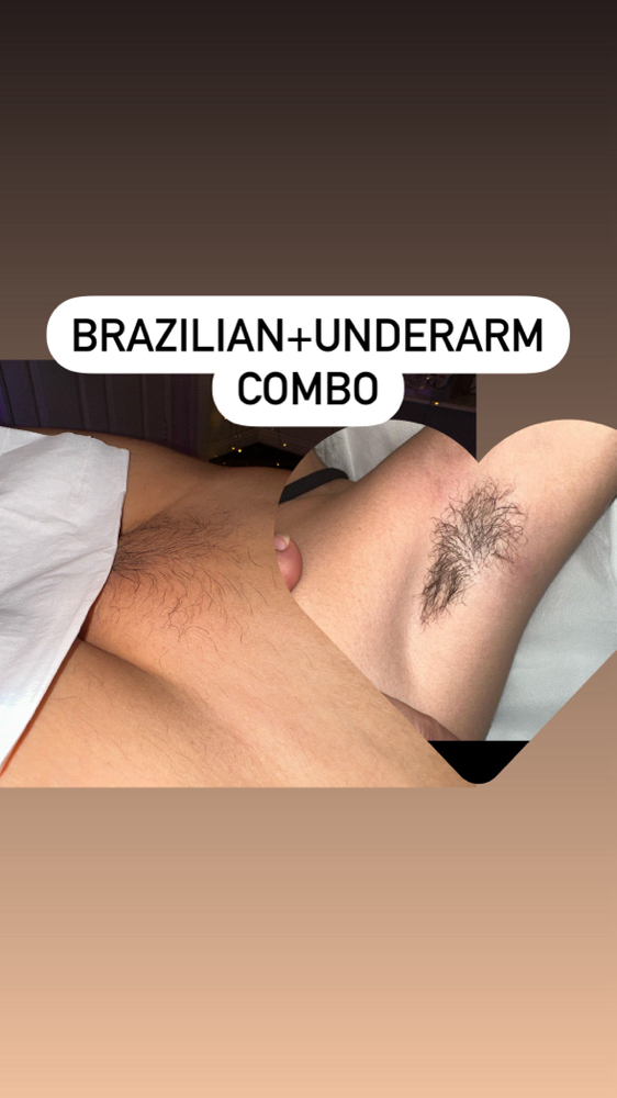 Brazilian+Underarm