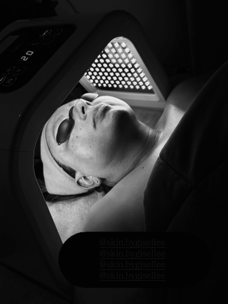 LED Light Therapy at Skin by Giselle in Commerce City, CO