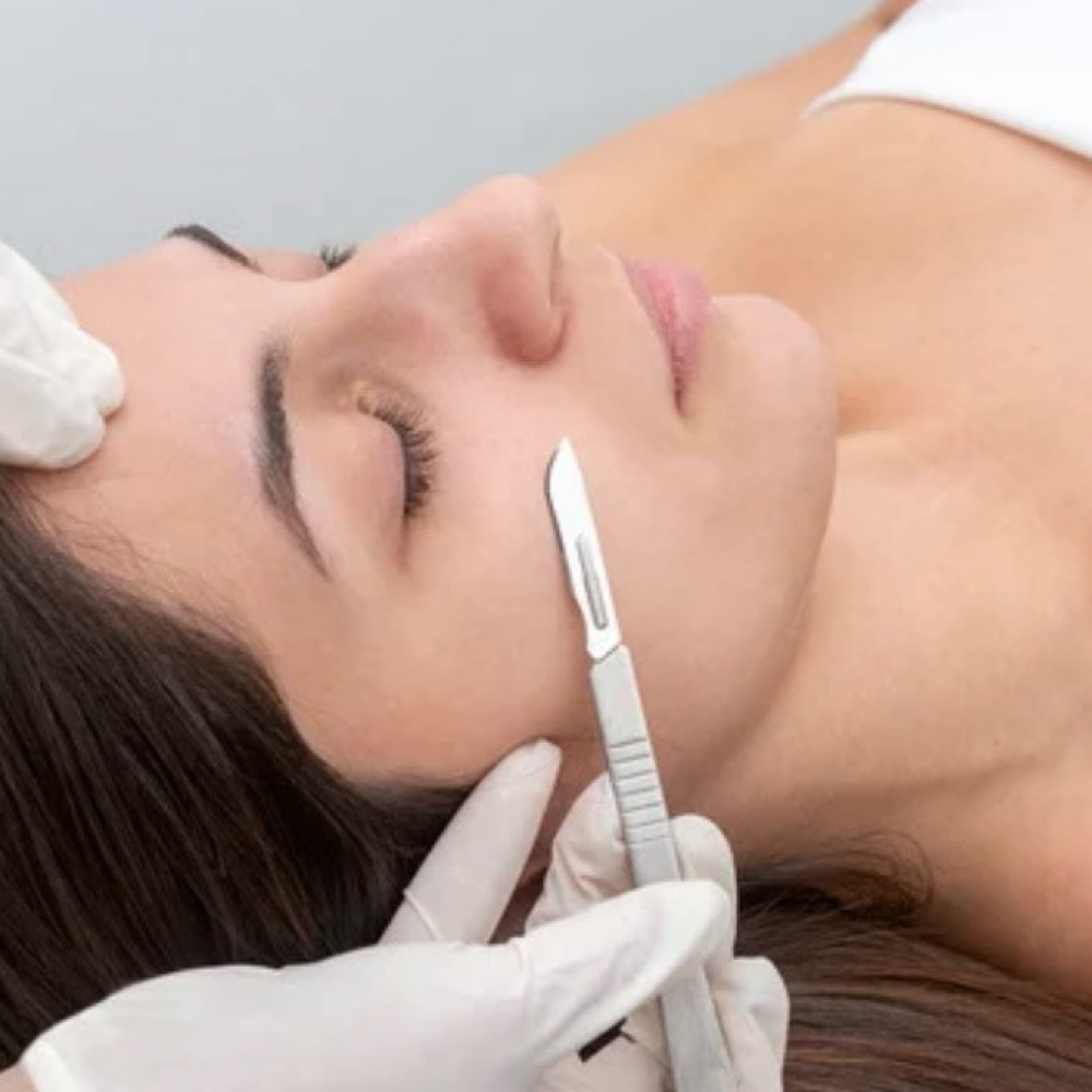 Dermaplaning at Fresh Complexions in Saint Helens, OR