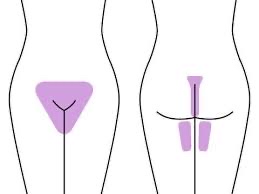 Extended Brazilian Waxing