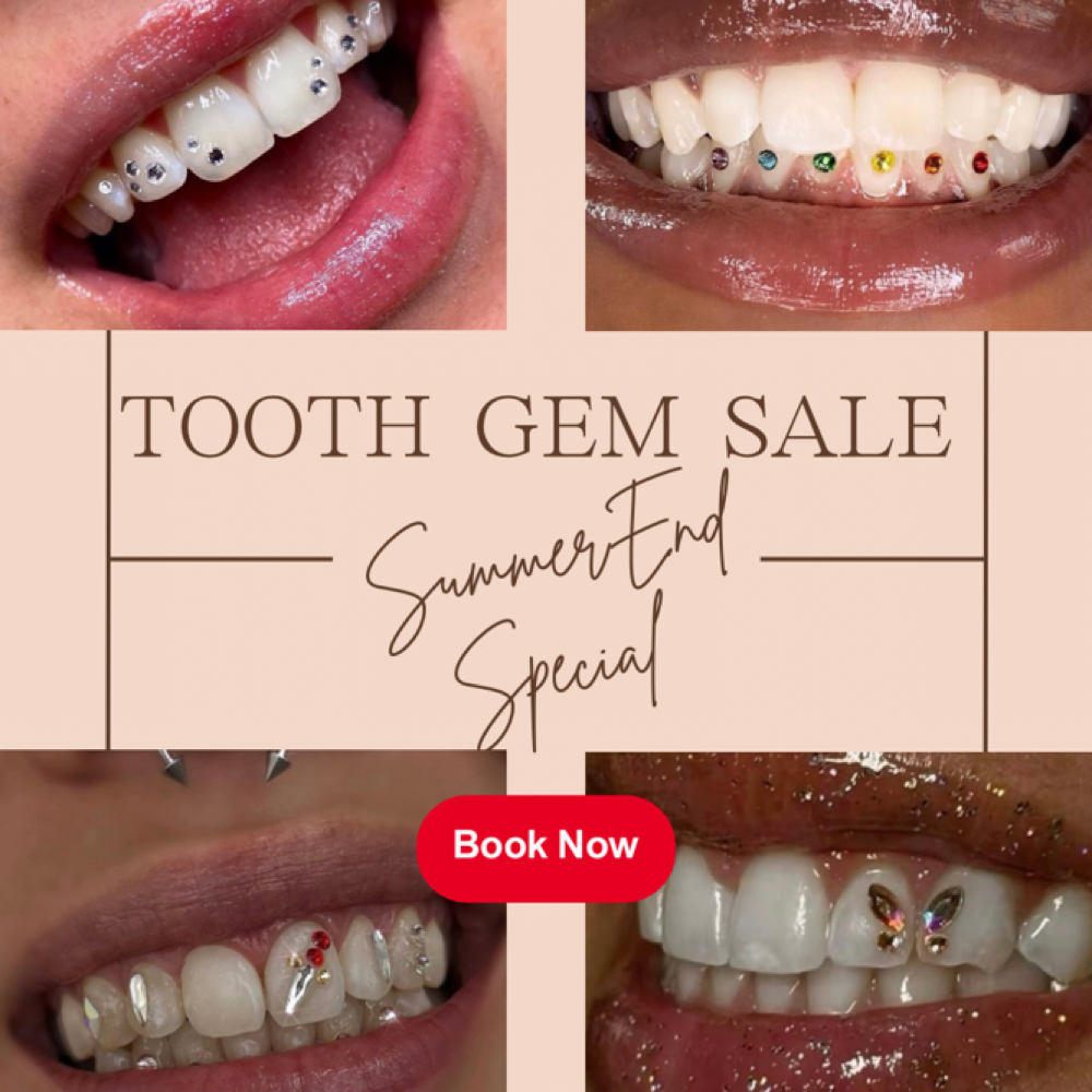 Tooth Gem Special at Golden Hour Esthetics & More in Warsaw, IN