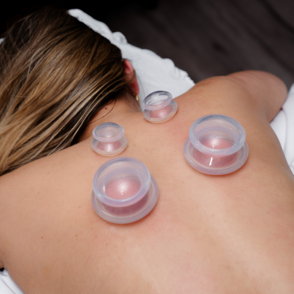 Cupping Therapy at Divine Touch Massage Therapy in Houston, TX