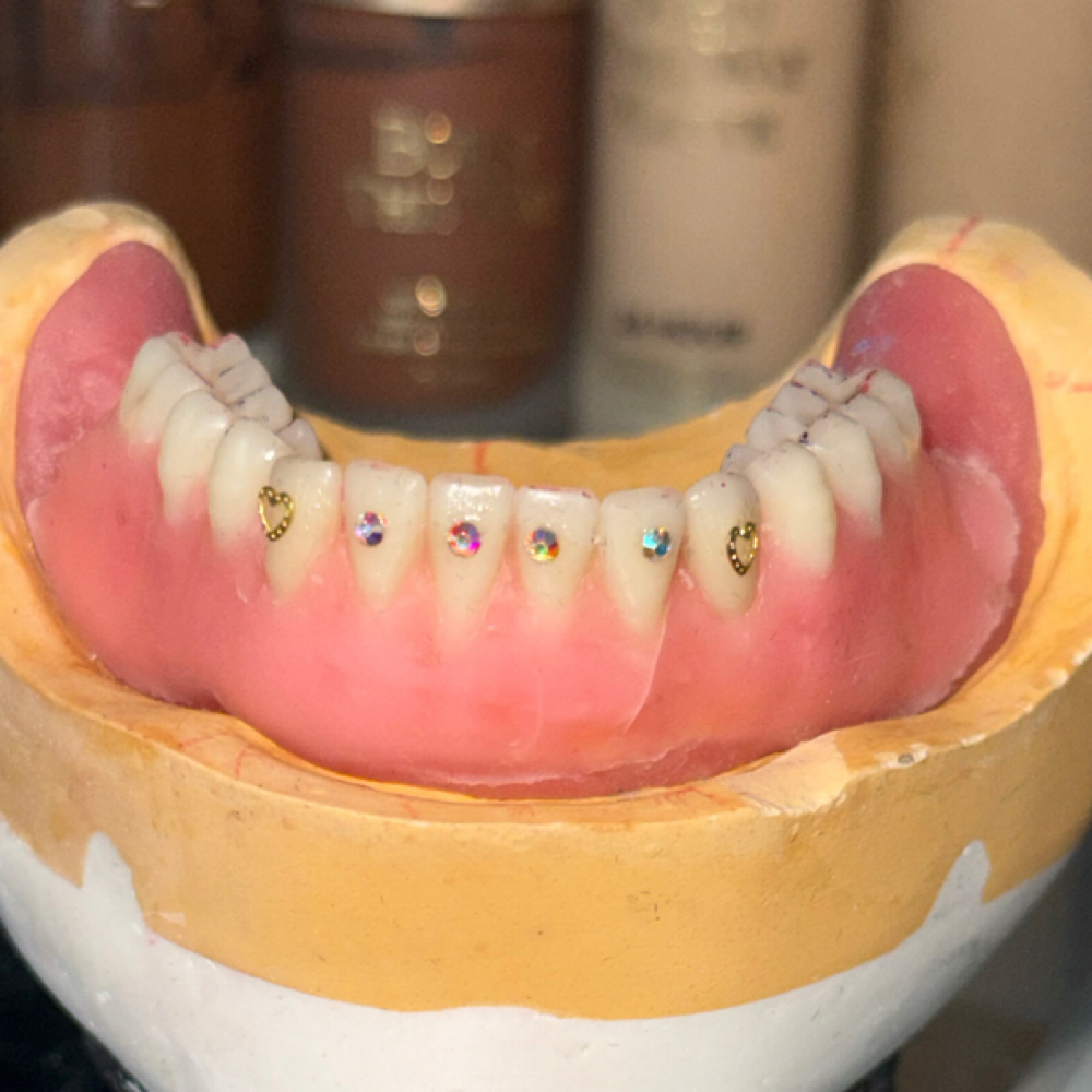 Tooth Gems at Mari Anderson in Racine, WI