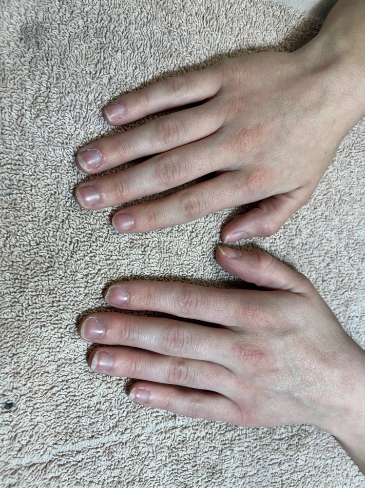 PRODUCT REMOVAL