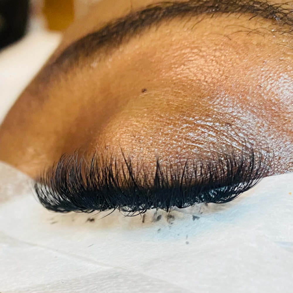 Fill: 2-week Volume at S.T. Esthetics in Michigan City, IN