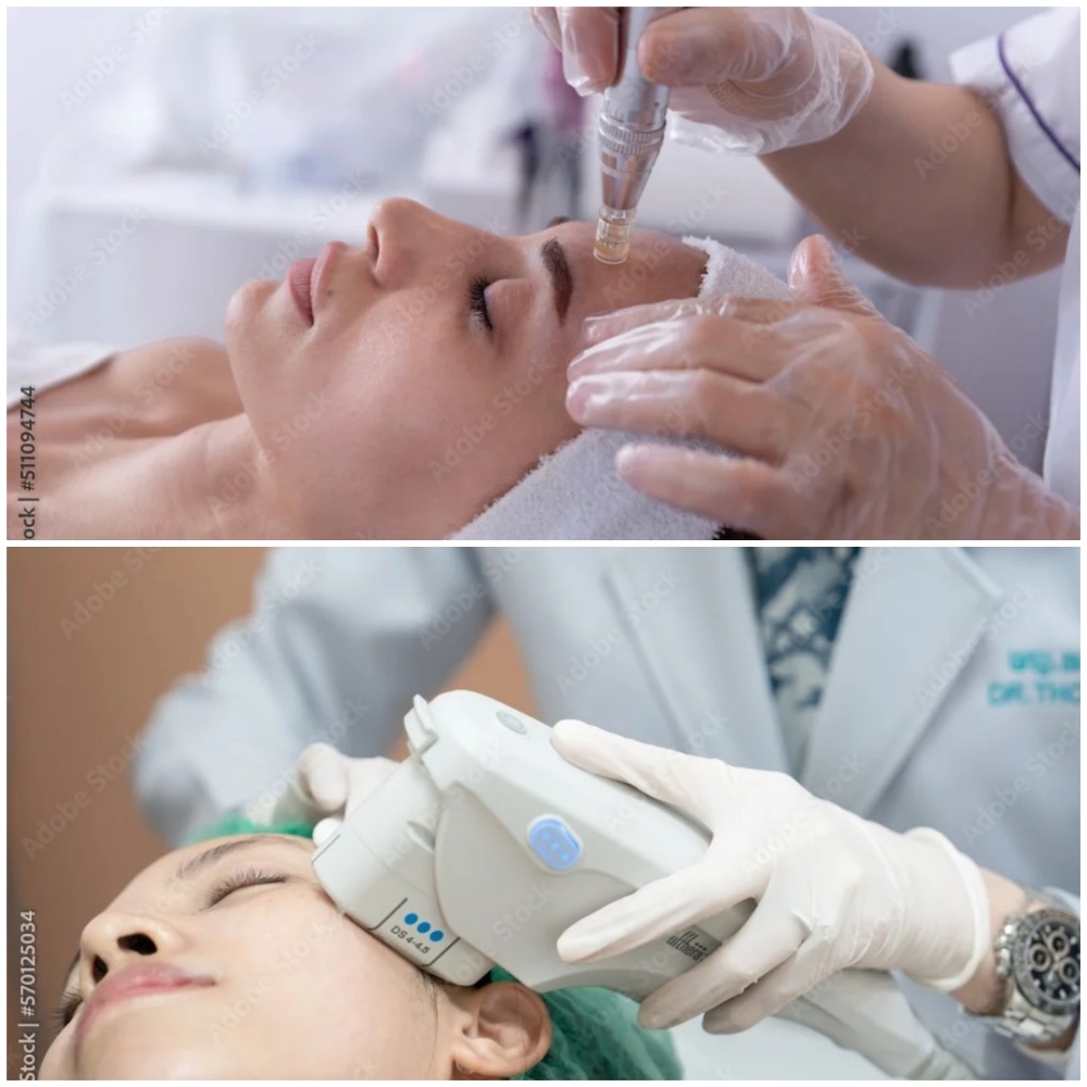 HIFU & Microneedling