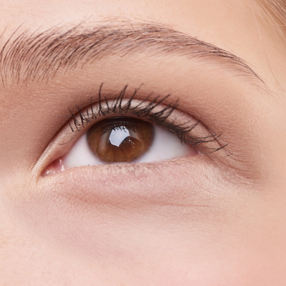 PRP For Undereyes