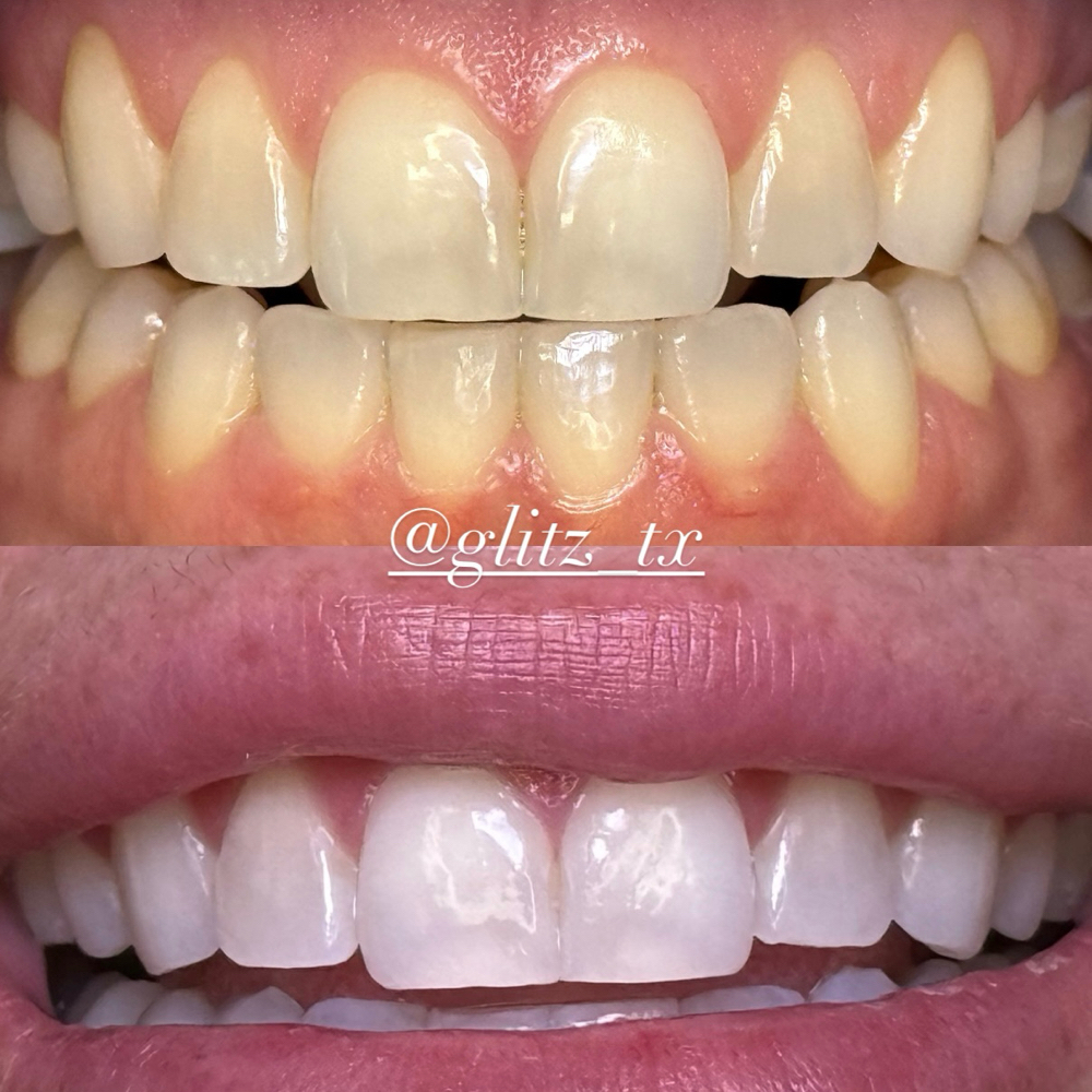 BRIGHT WHITE at Glitz_Tx in San Antonio, TX