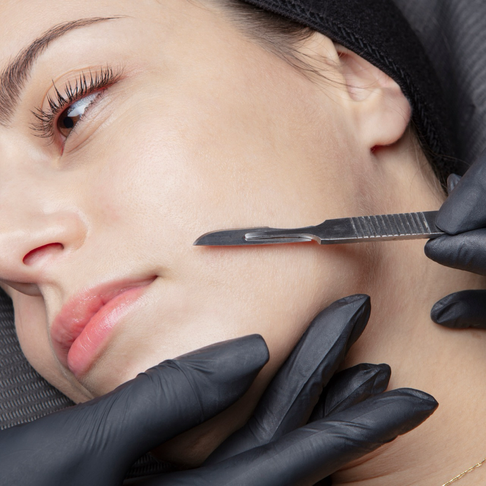 Dermaplaning Treatment