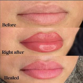 The Lips