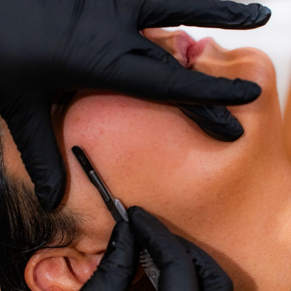 Dermaplane + Peel at Skin Laboratories by Kim in Glendale, AZ