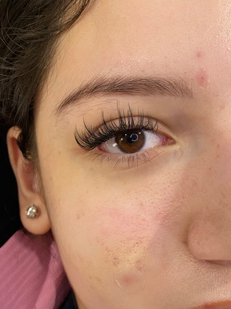 Hybrid FILL