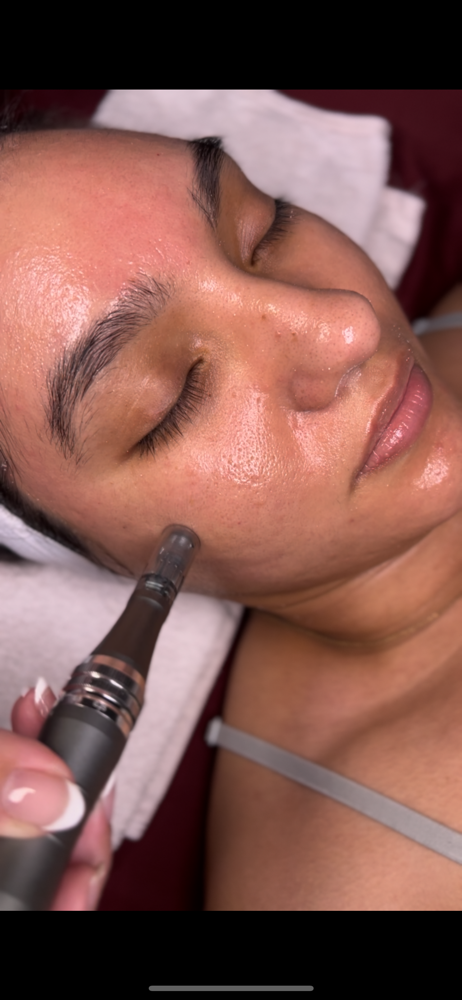 Nano Infusion