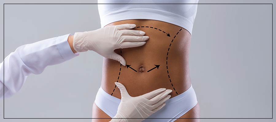Skin Tightening Rm 24