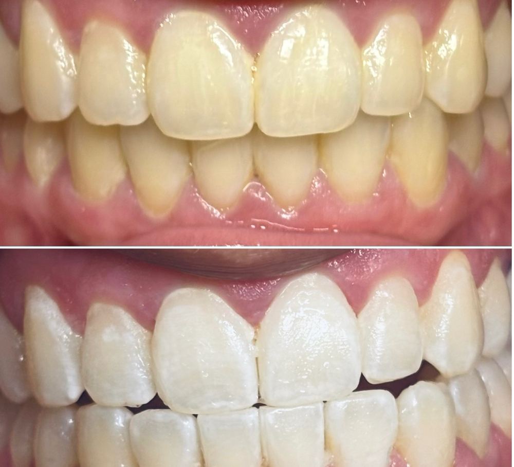 Touch Up (Previous Client)