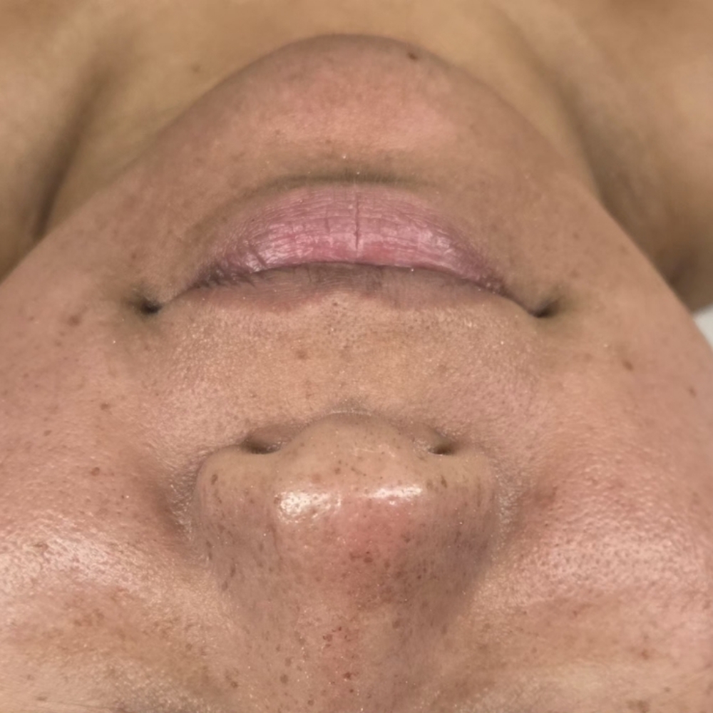 Face Wax at Midtown Esthetics in Raleigh, NC