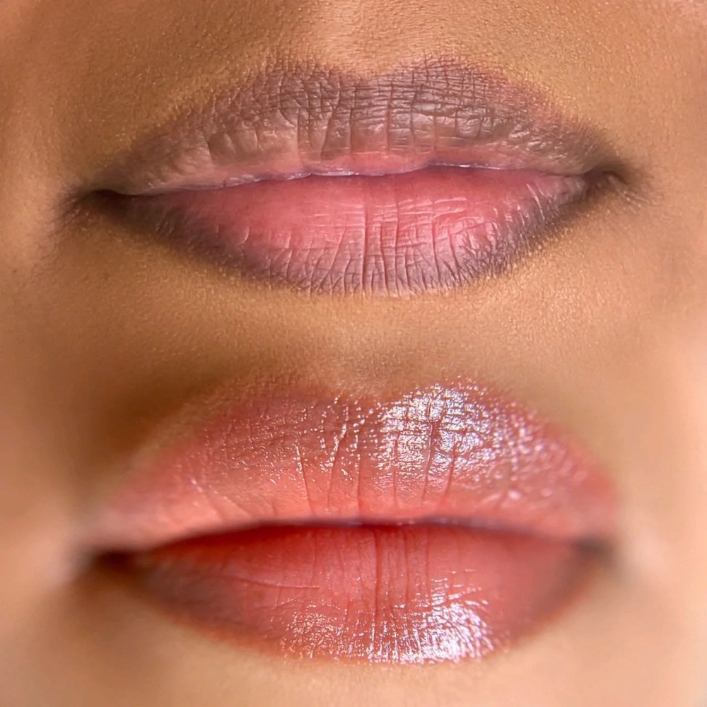 Lip Neutrualization