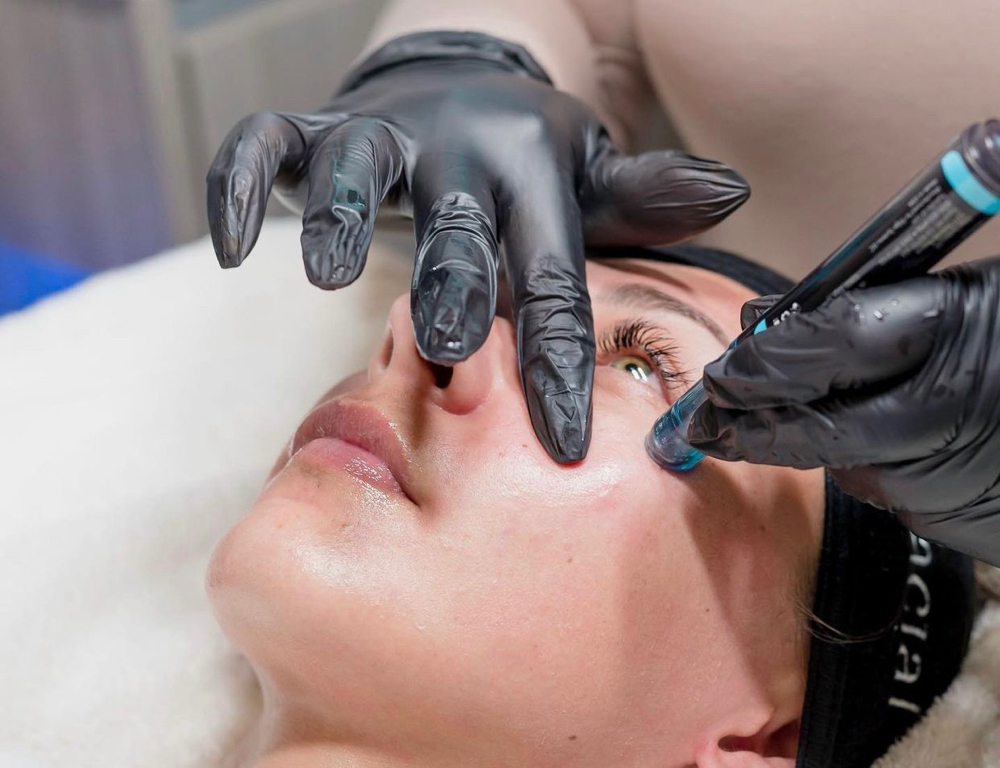 Hydrafacial Perk Eye Treatment