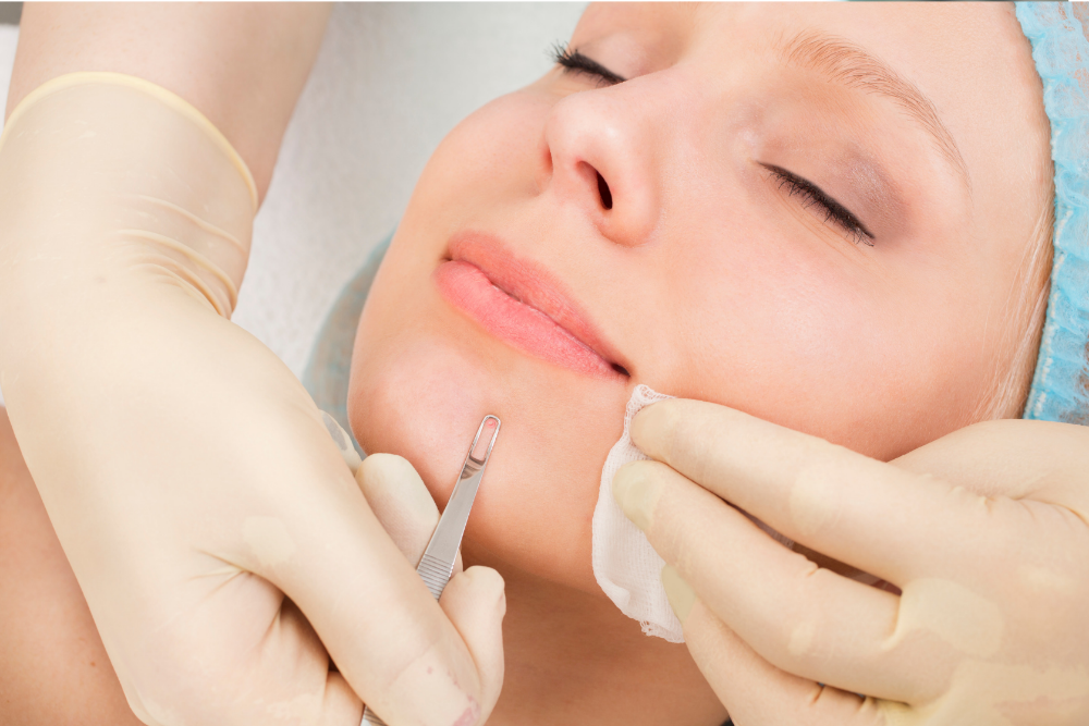 New Client Dermaplane Facial