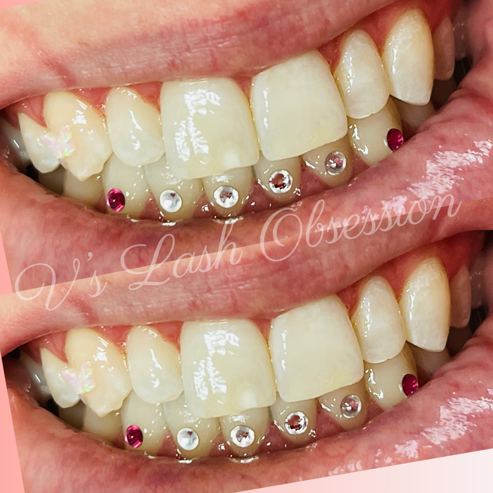 Straight Across Bottom Tooth