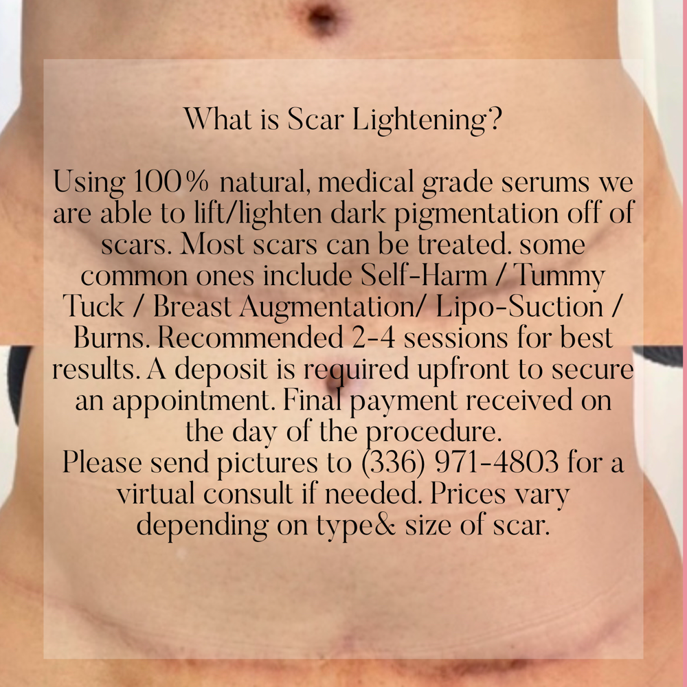 Scar Lightening
