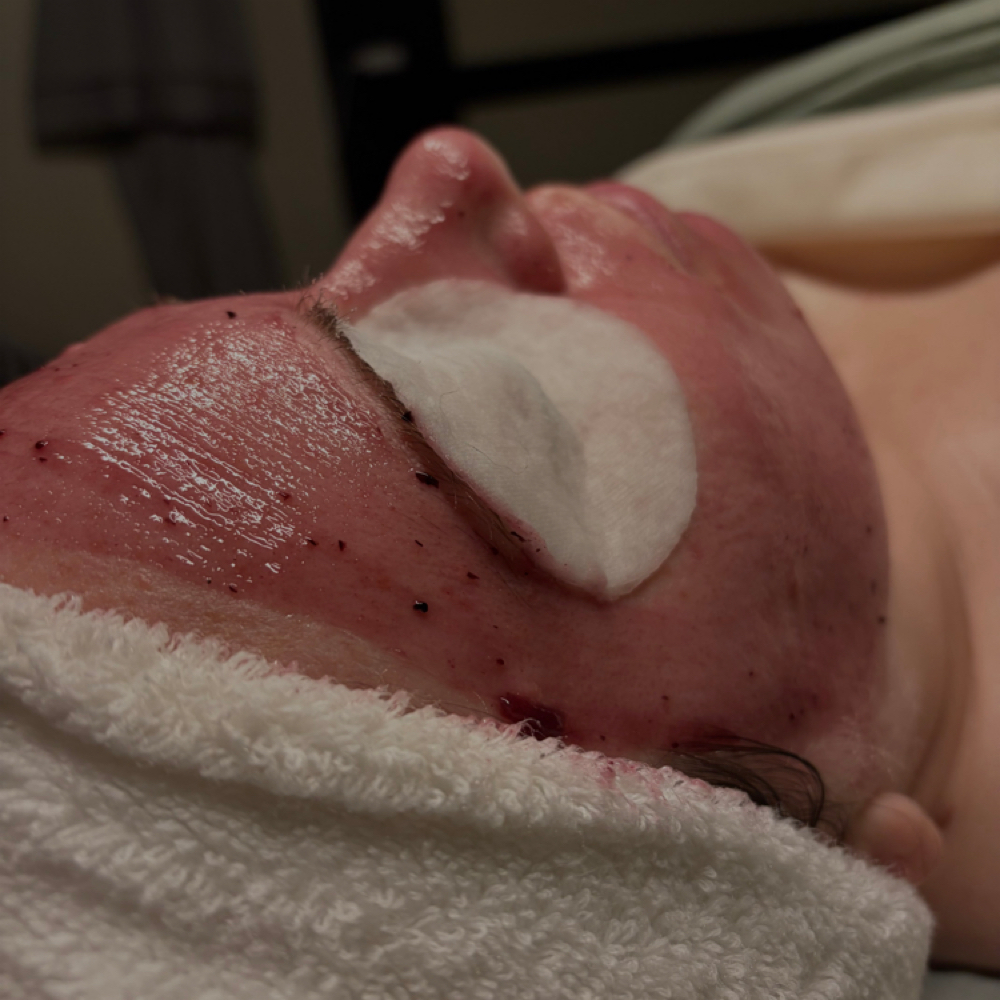 60 Minute Customized Facial at True Aura Wellness and Skin LLC in Lees Summit, MO