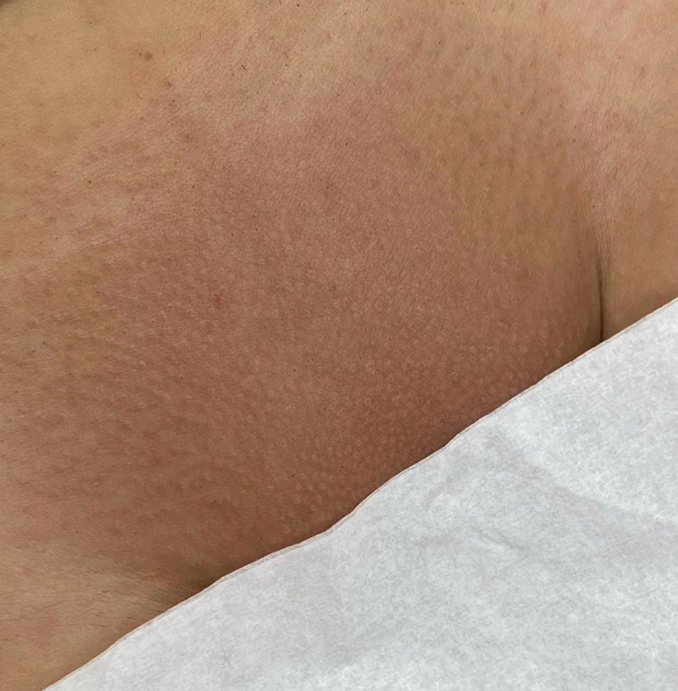 Brazilian Wax (F)