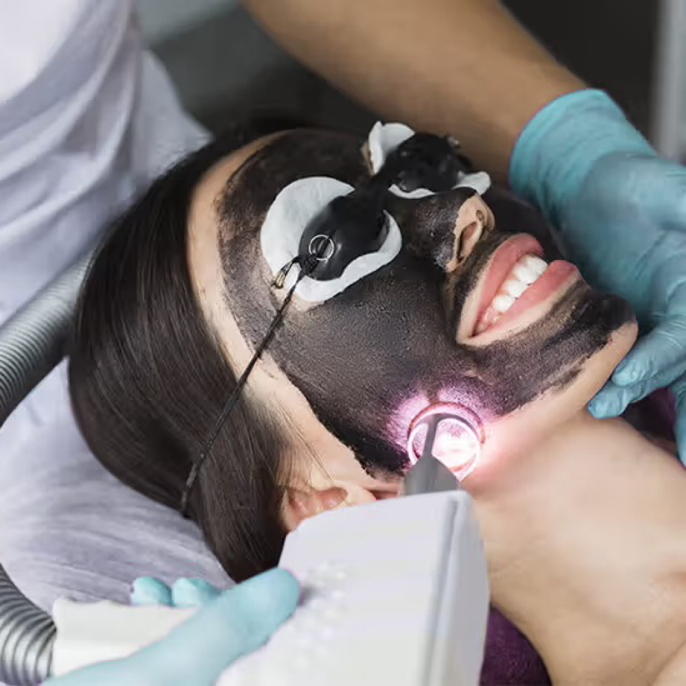 Carbon Laser Peel at Cedar & Sage Aesthetics & Wellness in Hiawassee, GA