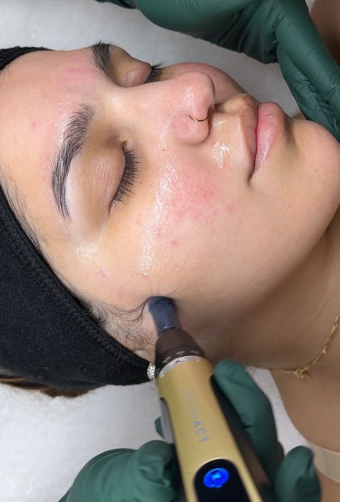 Nano Infusion Therapy