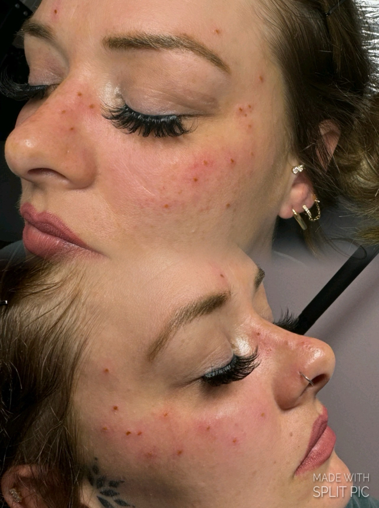 Faux Freckles