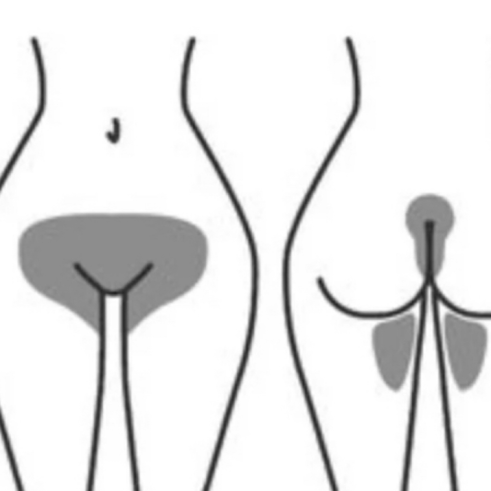 Full Brazilian Waxing (Women Only) at Beauty Esthetics Loft in Denver, CO