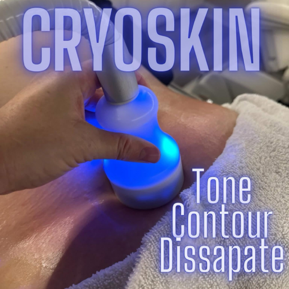Cryoskin at ARock Beauty & Wellness in San Angelo, TX