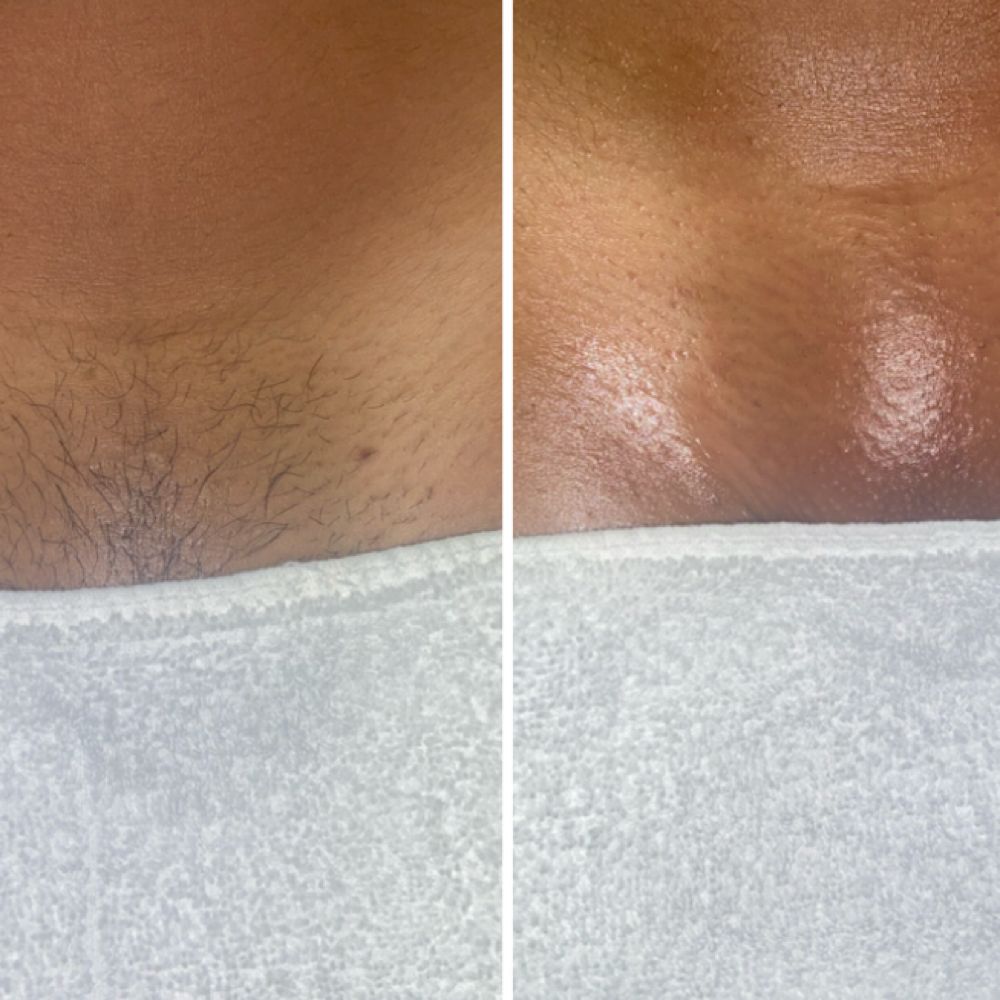 Brazilian Wax at The Pink Beauty Lab in Lakeland, FL