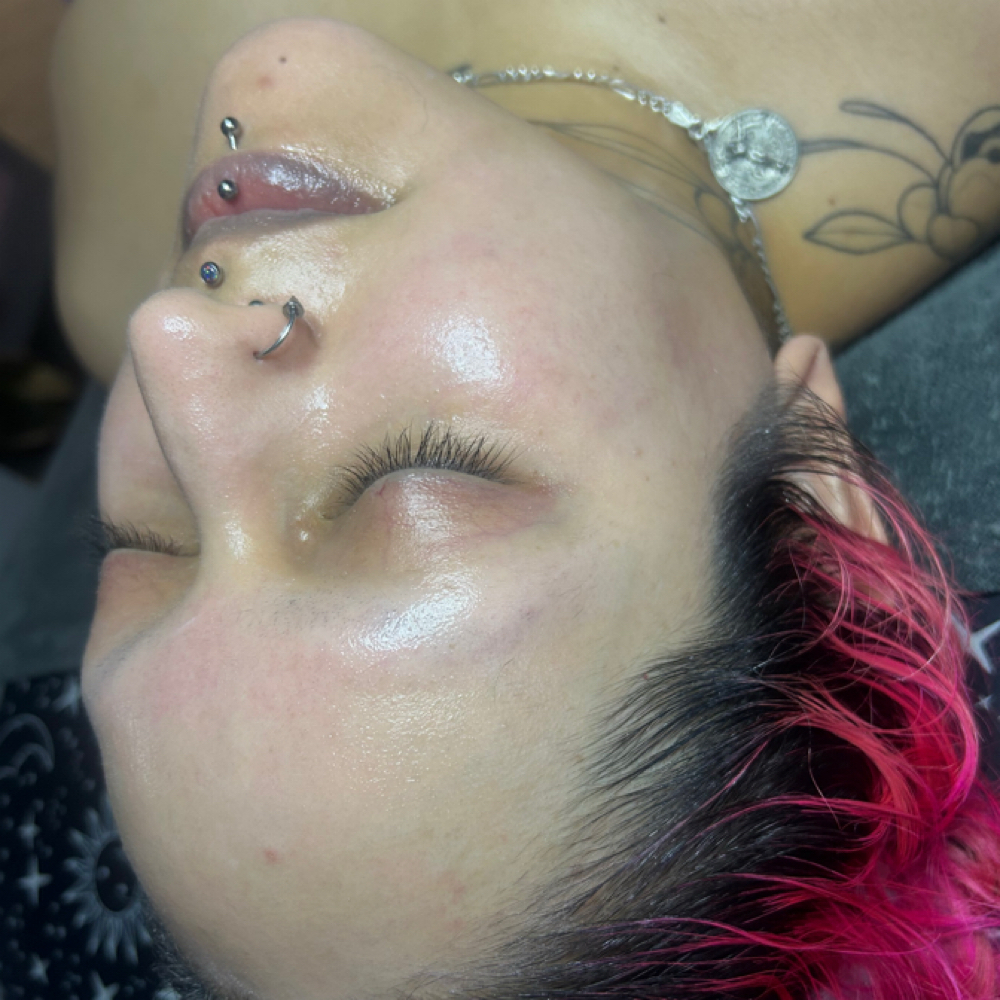 Custom Facial (Acne / Aging Skin ) at Skin Spells Esthetics in Roscoe, IL