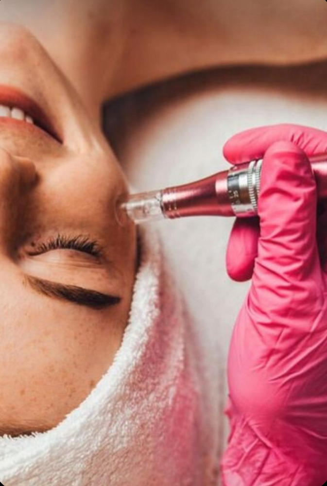 Microneedling