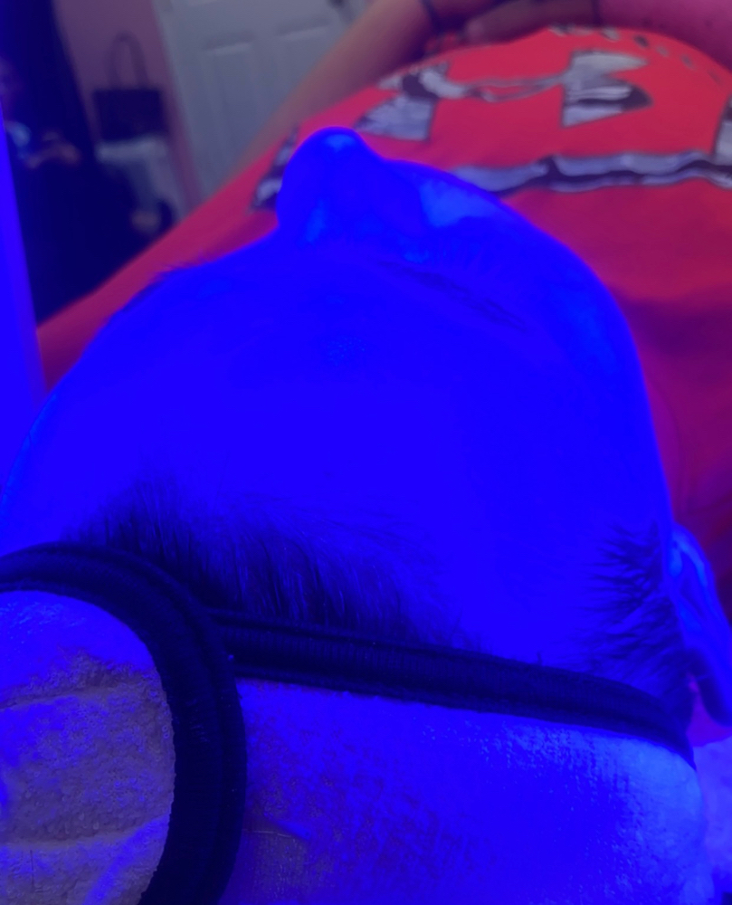 Light Therapy
